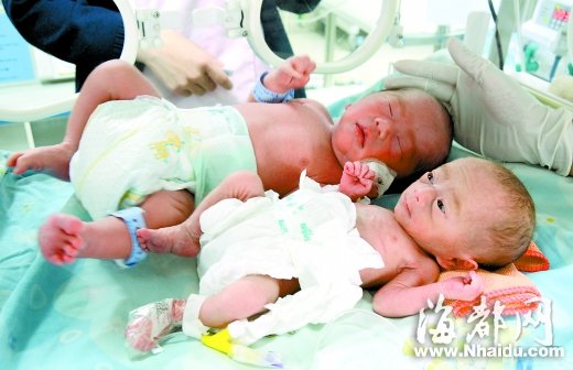 女子产下双胞胎：哥哥体重4斤 弟弟仅700克