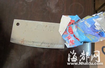 女子为泄愤抄起菜刀砍断8岁儿子三根手指