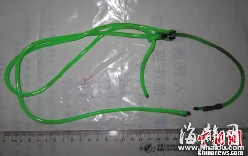 男子为求刺激将一米长绳捅进尿道 送医手术