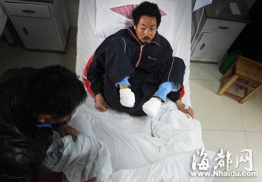 安徽定远男子没钱看病用茶杯碎片自断双脚