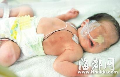 年轻妈妈用塑料袋提新生儿上医院 自称在网吧产子(图)