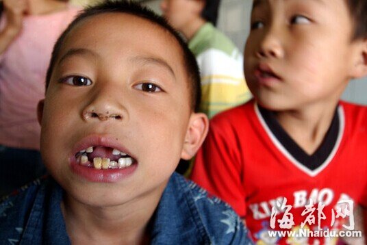 湖南致300名儿童血铅超标涉污企业被关停