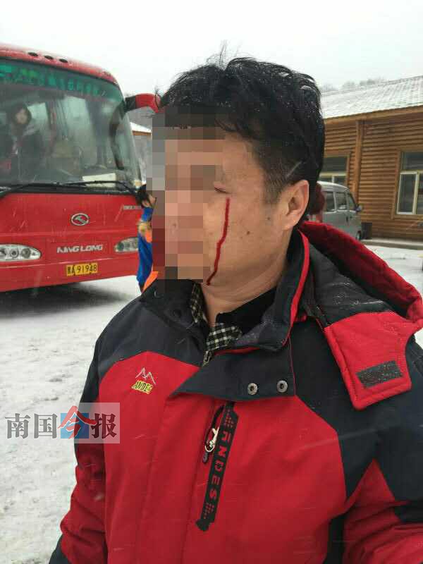 柳州王先生在哈尔滨旅游时被导游打伤。图由采访者提供