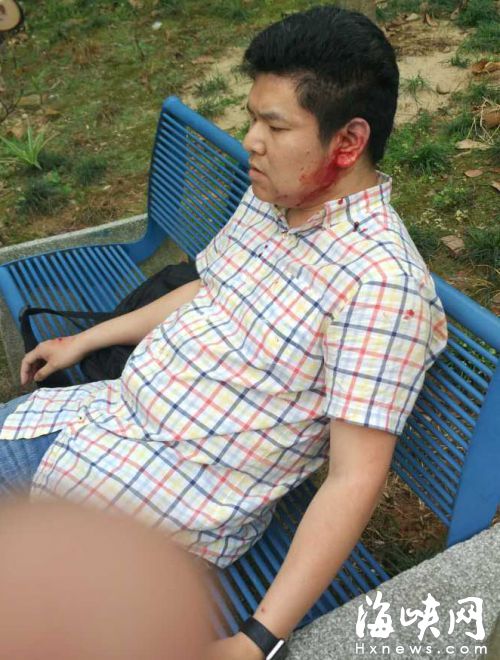 业主林先生左耳朵被打裂