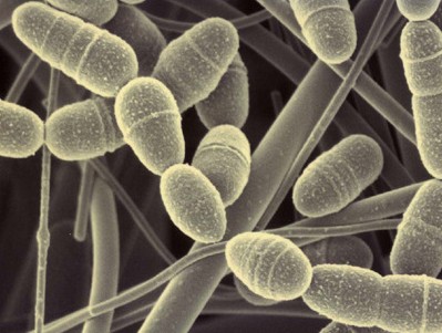 美国发现无敌细菌 以后这种无敌细菌用什么药治？