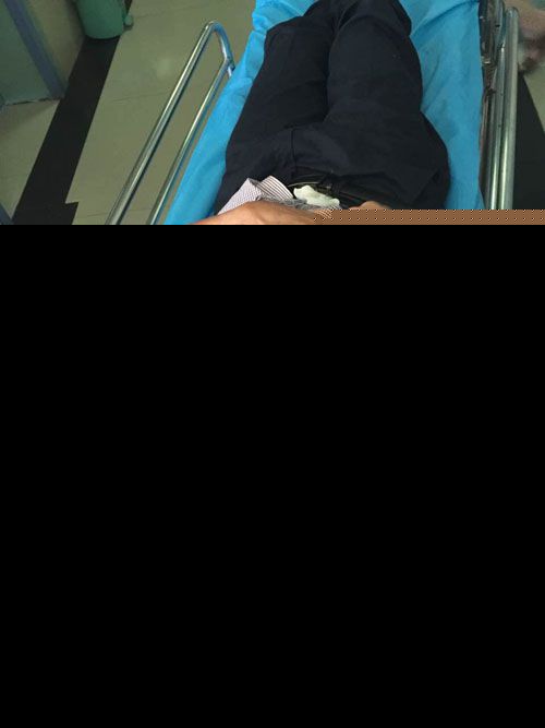 陈师傅说自己全身多处被打