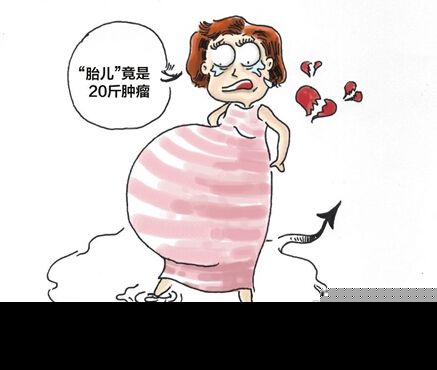 离异少妇“怀孕”险些丢命 竟是20斤重肿瘤