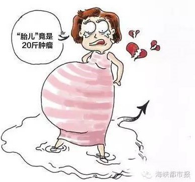 离异少妇“怀孕”险丢命 胎儿竟是20斤肿瘤