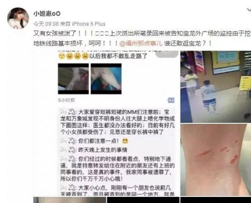 福州宝龙又有短裙妹纸被泼不明液体!一个月发现四起