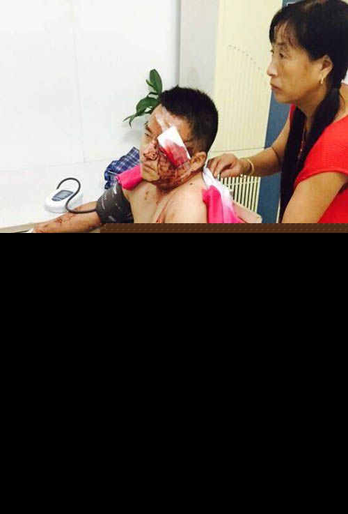金山一网吧冲进持刀男滥砍顾客 警方已介入调查