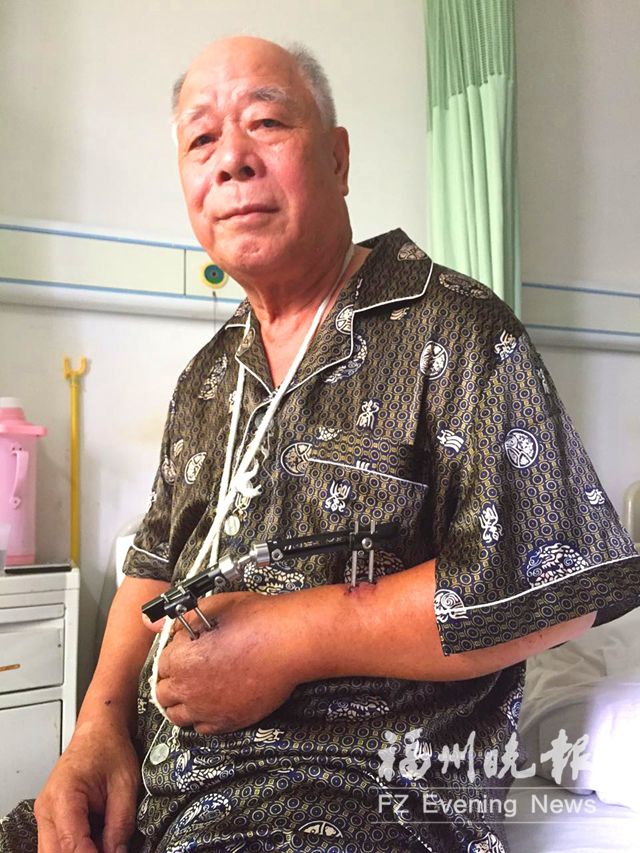 74岁退休民警遇骗赌团伙一声吼 却被撞倒手臂骨折