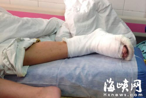 路墩破损利如刃 福州男童脚面皮被掀起缝了15针
