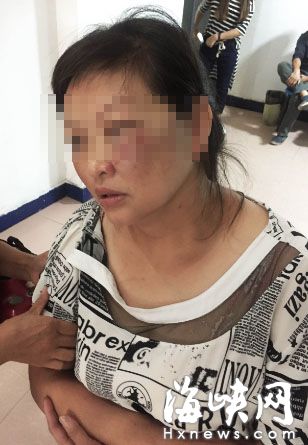 路虎剐蹭电动车 女骑手脸被打肿 事发福州龙院路