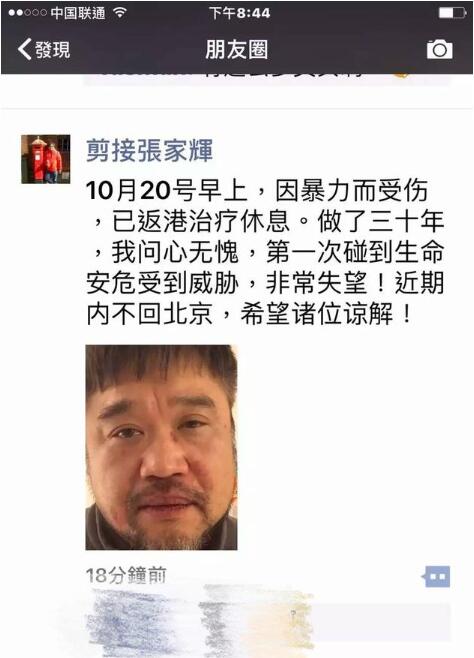 香港金牌剪辑师内地被打 张嘉辉被打事件经过个人资料微博