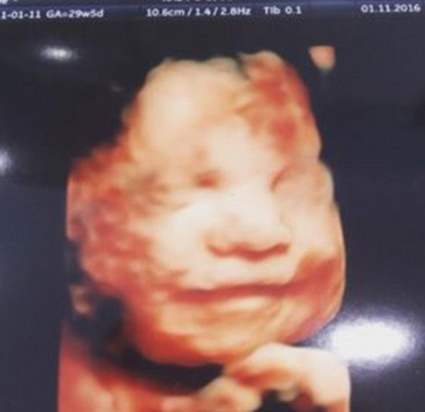 神奇的微笑！英国30周胎儿接受4D孕检 展露笑容