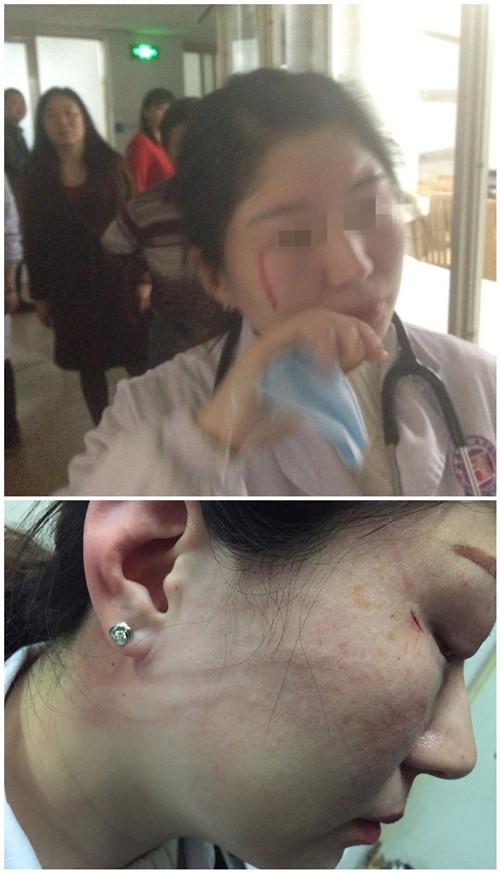 湖南：患者将女医生打致视网膜挫伤 还威胁“要你毁容”