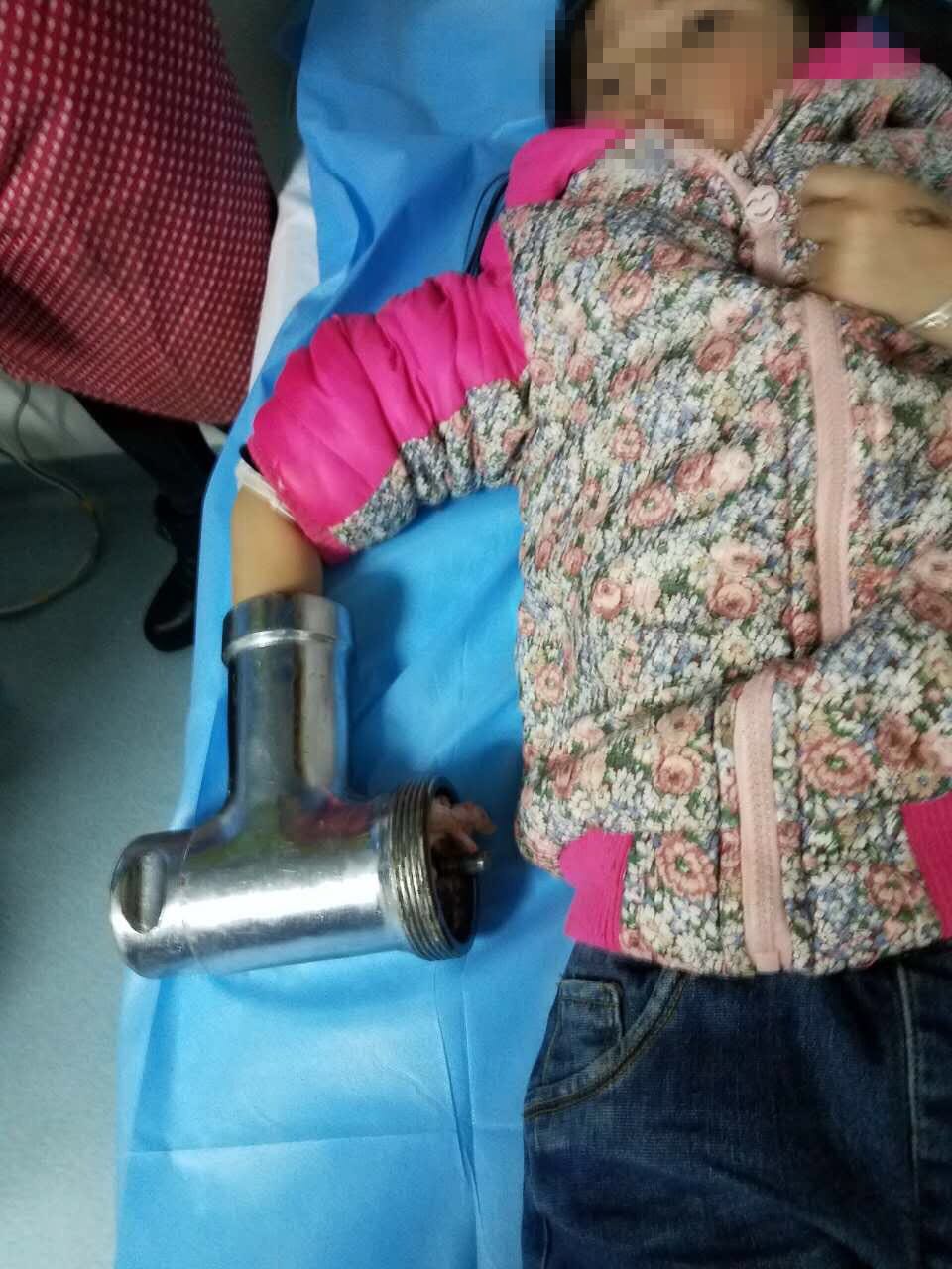 6岁女孩因好奇将手伸进绞肉机 整个右手被搅碎