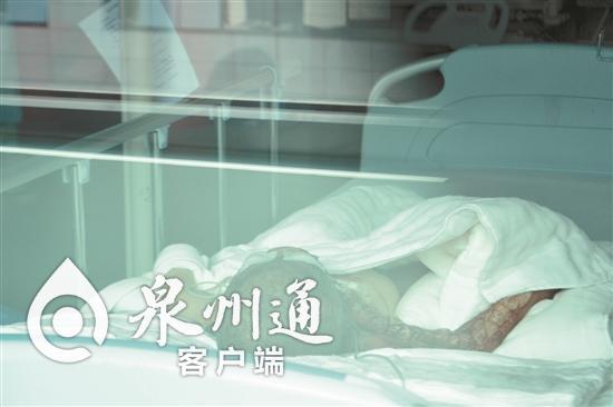 2岁男孩特重度烧伤危在旦夕 父母无力承担手术费