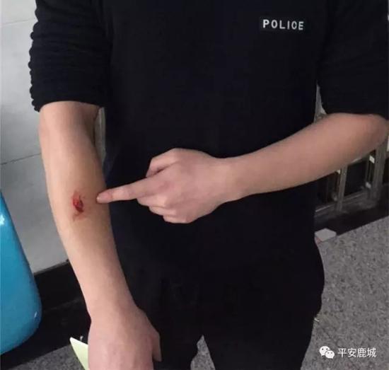 贵州一毒贩拒捕咬伤民警 押解途中自称患有艾滋