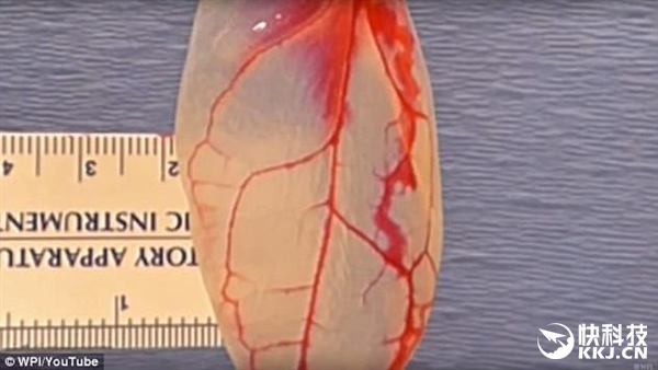 人造心脏来了：科学家用菠菜叶培育出“心脏组织”