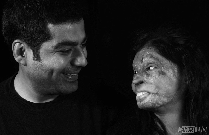 印度摄影师吉拉拍酸袭幸存者 展示艰辛反对暴力