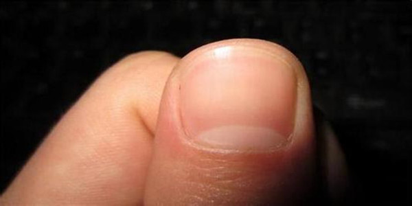 指甲上的小月牙与人体健康存在关联吗？
