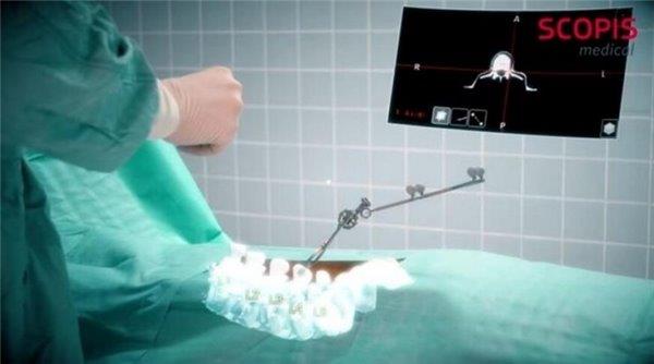 HoloLens越来越专业了 这次它进了脊柱手术的手术室
