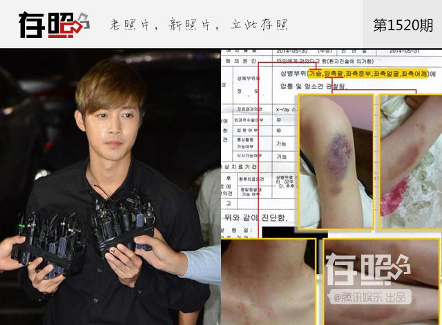 遇人不淑，她们掉入娱乐圈花美男的“桃色陷阱”，伤痕累累
