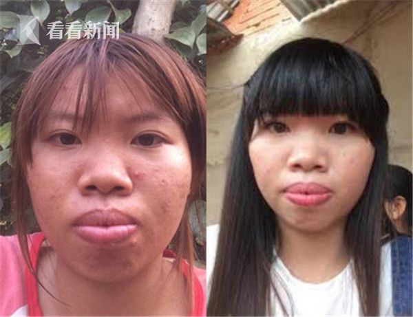 越南女子太丑没人肯娶 越南女子郭金凤整容后变美闪嫁富二代