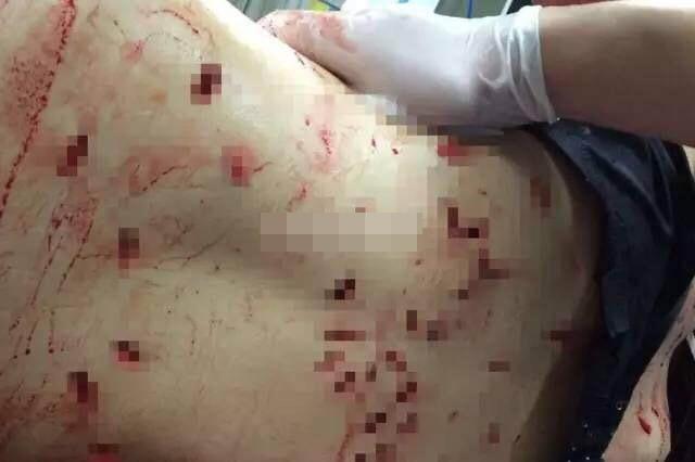 郑州女子遭报复被刺66刀 浑身是血倒在电梯间门口