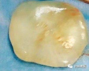 浙江一新生女婴带玉出生，而且和贾宝玉的玉相似度达96%！