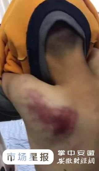 安徽亳州一学生迟到两分钟遭老师殴打，打断四把扫把！