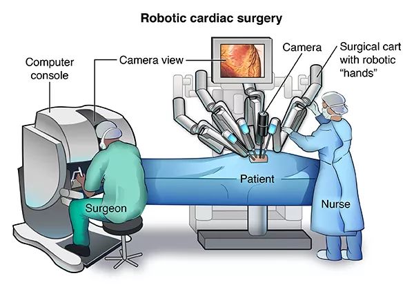 机器人心瓣手术怎么回事？机器人做心瓣手术过程曝光病人不久后去世