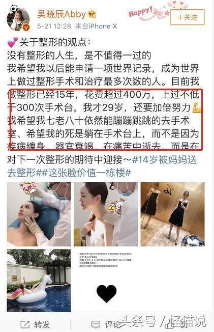 14岁的她就被妈妈拉去整容，从这开始就走上了一条整容的不归路