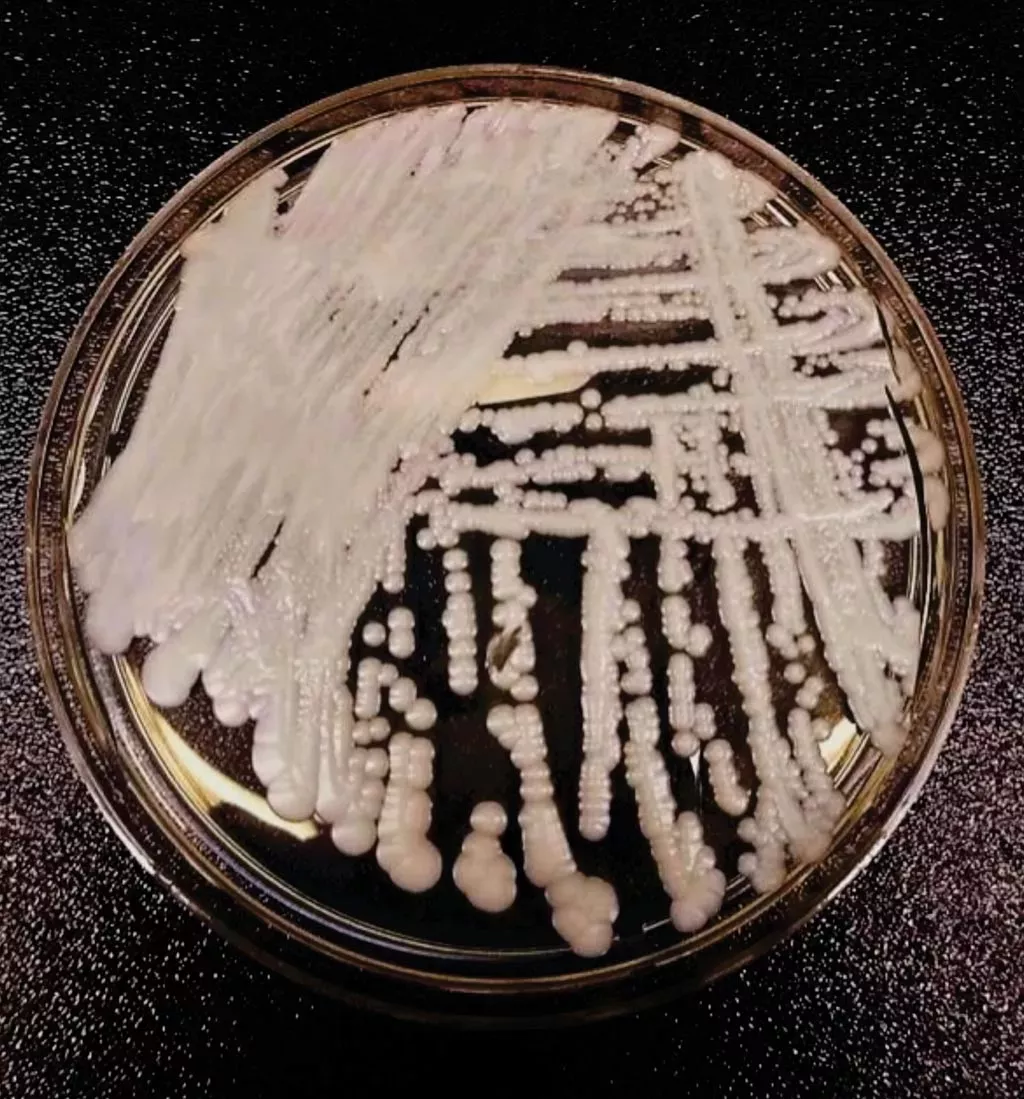 中国确诊18例超级真菌感染 超级真菌感染被美列为紧急威胁