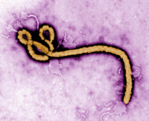 日本将引入埃博拉什么情况 日本引入埃博拉病毒开发诊断试剂