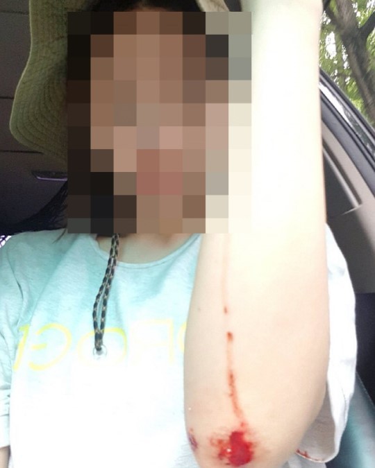 黄荷娜吸毒事件最新进展：黄荷娜获释出狱后近照公开