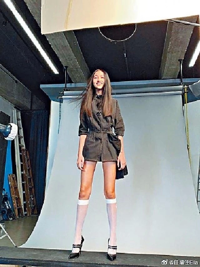 任达华公开伤势最新情况：右手还没拆线有点肿，换衣服抹身靠太太