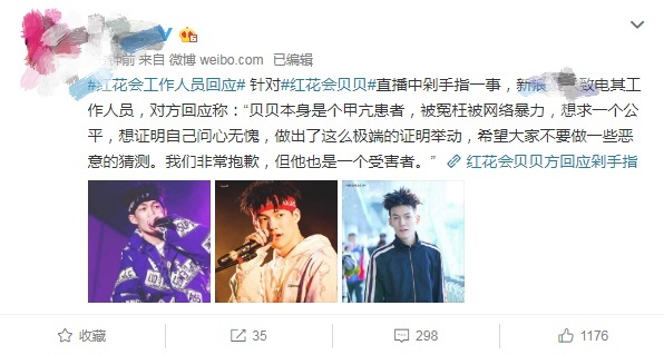 红花会贝贝因粉丝脱粉回踩直播剁手指，吓坏网友，本尊发文回应
