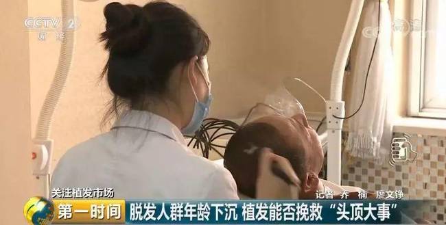 我国脱发人群超2.5亿详细情况 有关植发的三大误区是什么盘点