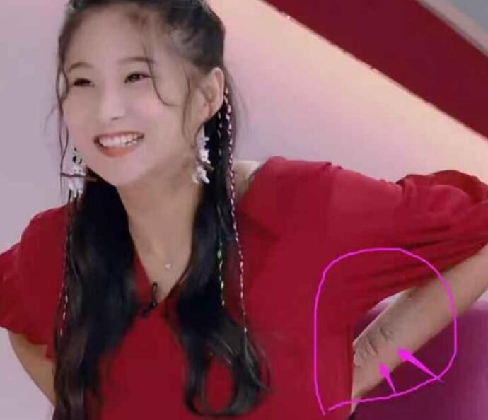 戚蓝尹手腕伤痕累累