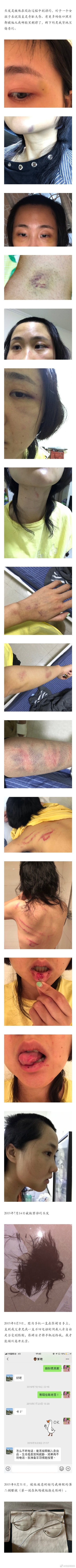 张嫮目疑家暴怎么回事？张嫮目家暴张珂玄现场图事件始末