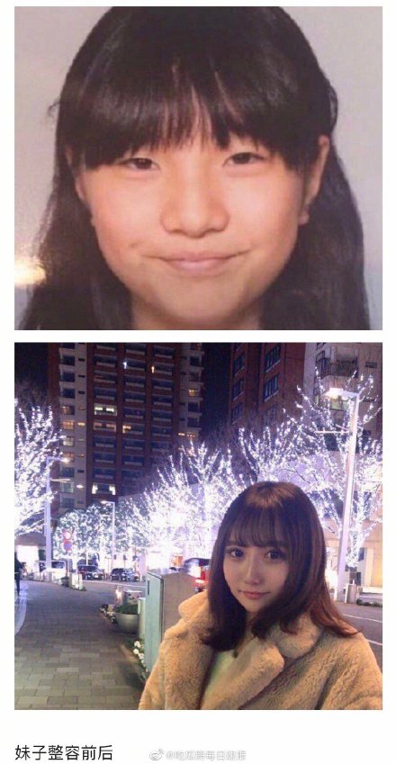 私生整容追到爱豆和队友具体什么情况？整容前后照片曝光简直鬼斧神工
