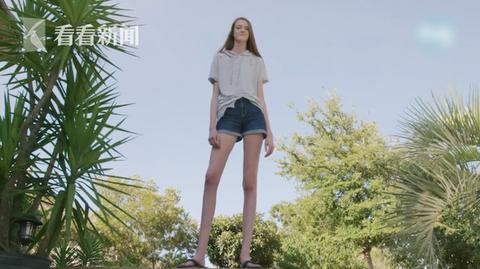 比吉尼斯纪录还长 美国16岁女生“逆天长腿”135厘米